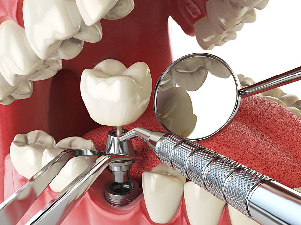 Best Emergency Dental Care for Sports Injuries in Beecher, MI